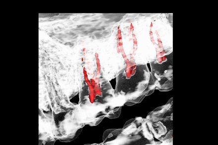 Ejemplo de escáner 3D CBCT mostrando anatomía de conducto radicular en Cherish Dental